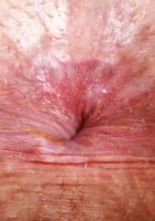 ATK Galleria: Amber Maddie (Amber Maddie has her bikini on)