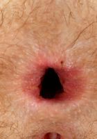 Amy fay spreads and gapes her hairy holes., Amy Faye (amy046) ATK Petites: Amy Faye (Amy fay spreads and gapes her hairy holes.)