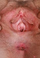 ATK Natural & Hairy: Apricot Pitts (Apricot Pitts Flaunts her Fur and Spreads)