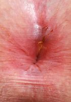Bess Breast Has The Best Tits, Bess Breast (bes004) ATK Natural & Hairy: Bess Breast (Bess Breast Has The Best Tits)