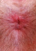 ATK Natural & Hairy: Big Eyes (Big Eyes whips out the big guns)