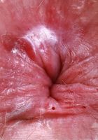 ATK Natural & Hairy: Big Eyes (Big Eyes whips out the big guns)