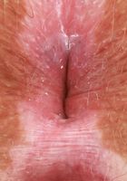Bratty Wolfie gets naked outside, Bratty Wolfie (bra041) ATK Natural & Hairy: Bratty Wolfie (Bratty Wolfie gets naked outside)