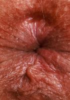 ATK Galleria: Emily Jade (Emily Jade slips off her shorts)