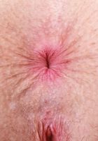 Fiona Peaches from ATK Natural & Hairy