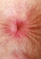 ATK Petites: Fiona Sprouts (Let Fiona Peaches put you in the mood)