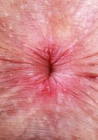 Fiona Peaches from ATK Natural & Hairy