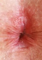 ATK Galleria: Ginger Grey (Ginger Grey Outdoor Lingerie)