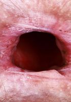 Jackie Hoff from ATK Natural & Hairy