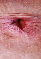 ATK Exotics: Julia James (Julia James is an angel in green)