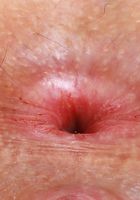 Lana Smalls Gapes her naked shaved pussy, Lana Smalls (lan037) ATK Galleria: Lana Smalls (Lana Smalls Gapes her naked shaved pussy)