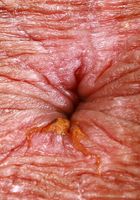 Leila Mills is looking fresh and perky, Leila Mills (lei030) ATK Petites: Leila Mills (Leila Mills is looking fresh and perky)