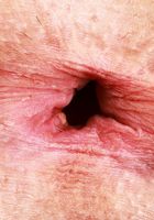 ATK Galleria: Nicole Nichols (Nicole Nichols is strapped)