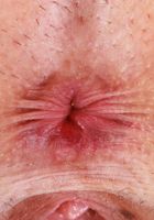 ATK Galleria: Nova Vixen (Nova Vixen Stretching and Stripping)