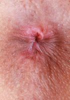 Sonia Sparrow Spreads and Gapes, Sonia Sparrow (son030) ATK Petites: Sonia Sparrow (Sonia Sparrow Spreads and Gapes)