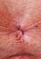 ATK Galleria: Summer Renee (Summer Renee is going to seduce you)